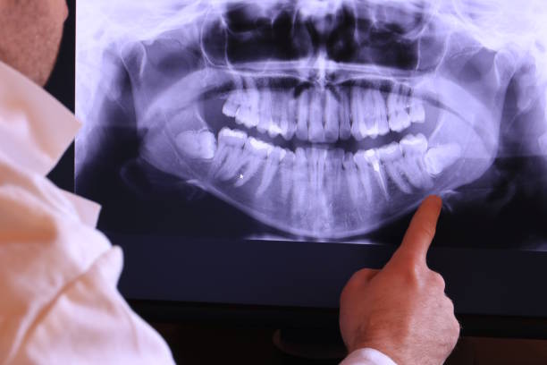 Best Cracked Tooth Emergency Dentist  in Washingtonville, NY