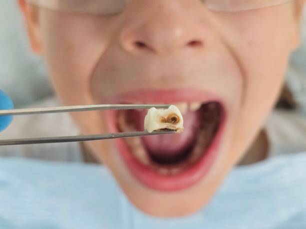 Best Dentist for Severe Toothache  in Washingtonville, NY